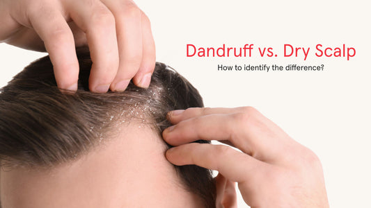 Dandruff vs. Dry Scalp: How To Identify The Difference?