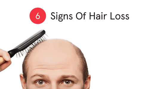 6 Early Signs You’re Going Bald & 6 Ways To Fight It