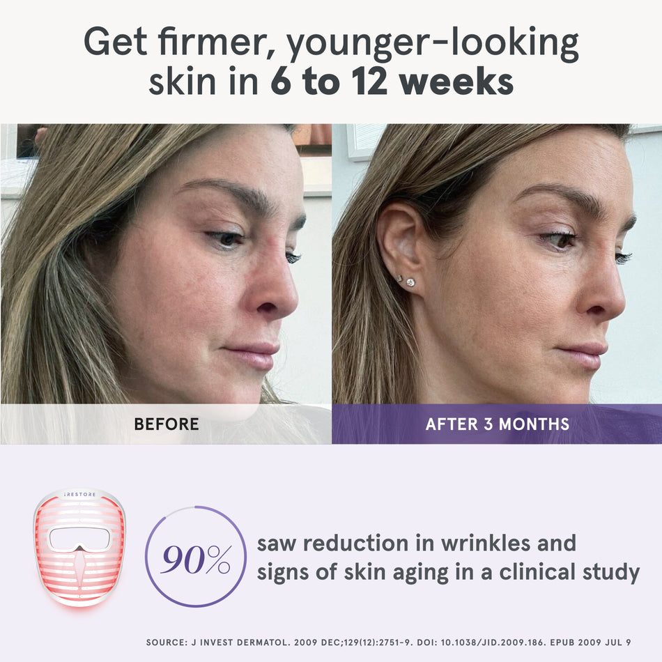 Side-by-side comparison of a woman’s profile showing visible improvements after using the iRESTORE LED face mask for 3 months, with a clinical study statistic highlighting 90% of users experienced reduced signs of aging