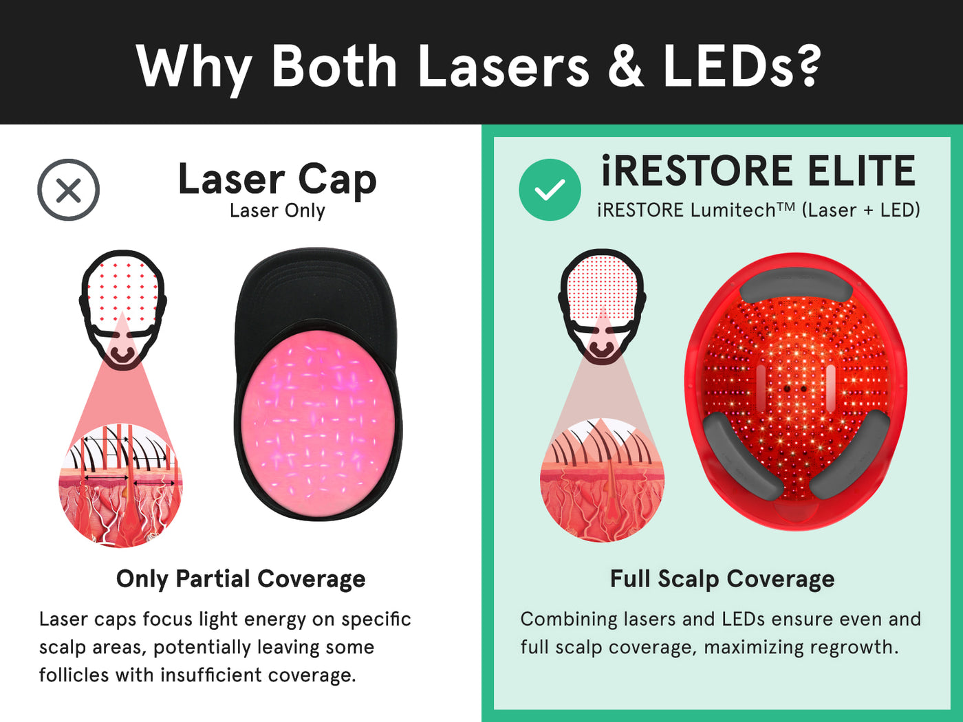 Irestore Elite Worlds Best Hair Growth Laser Device Fda Cleared