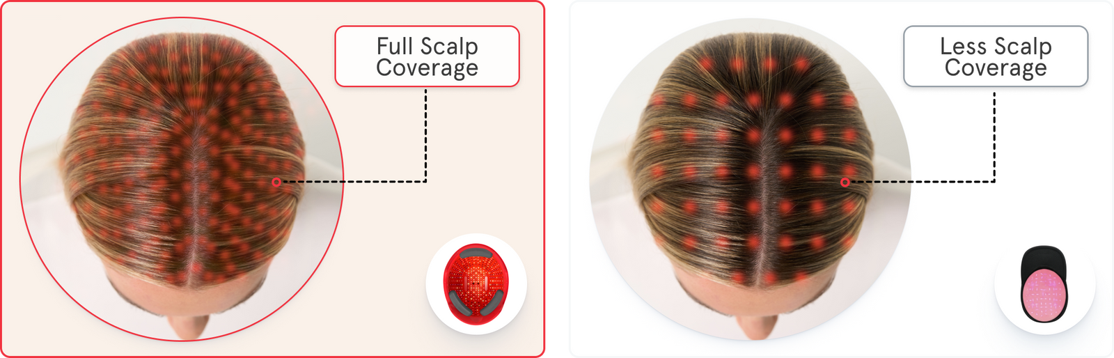 A side by side image comparing the coverage of iRESTORE compared to other laser cap. The left image shows the iRESTORE lElite device has full scalp coverage while the right image shows the laser cap with less scalp coverage.