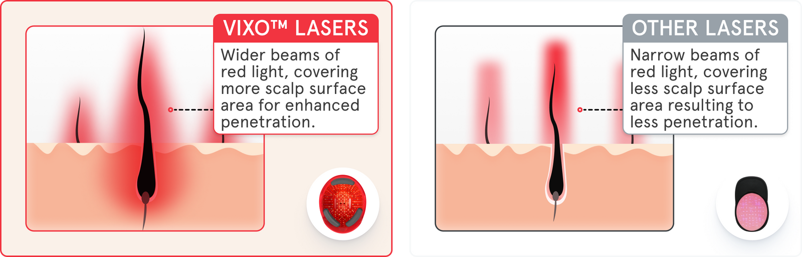 A side by side image comparing the lasers used in iRESTORE compared to other laser cap. The left image shows the iRESTORE helmet uses VIXO Lasers which has a wider beams of red light, covering more scalp surface area for enhanced penetration. While the right image shows the laser used by other laser caps which has narrow beam of red light, covering less scalp surface area resulting to less penetration.