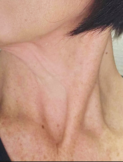 After image of woman's neck with even skin tone and lesser dark spots after 12 weeks of usage