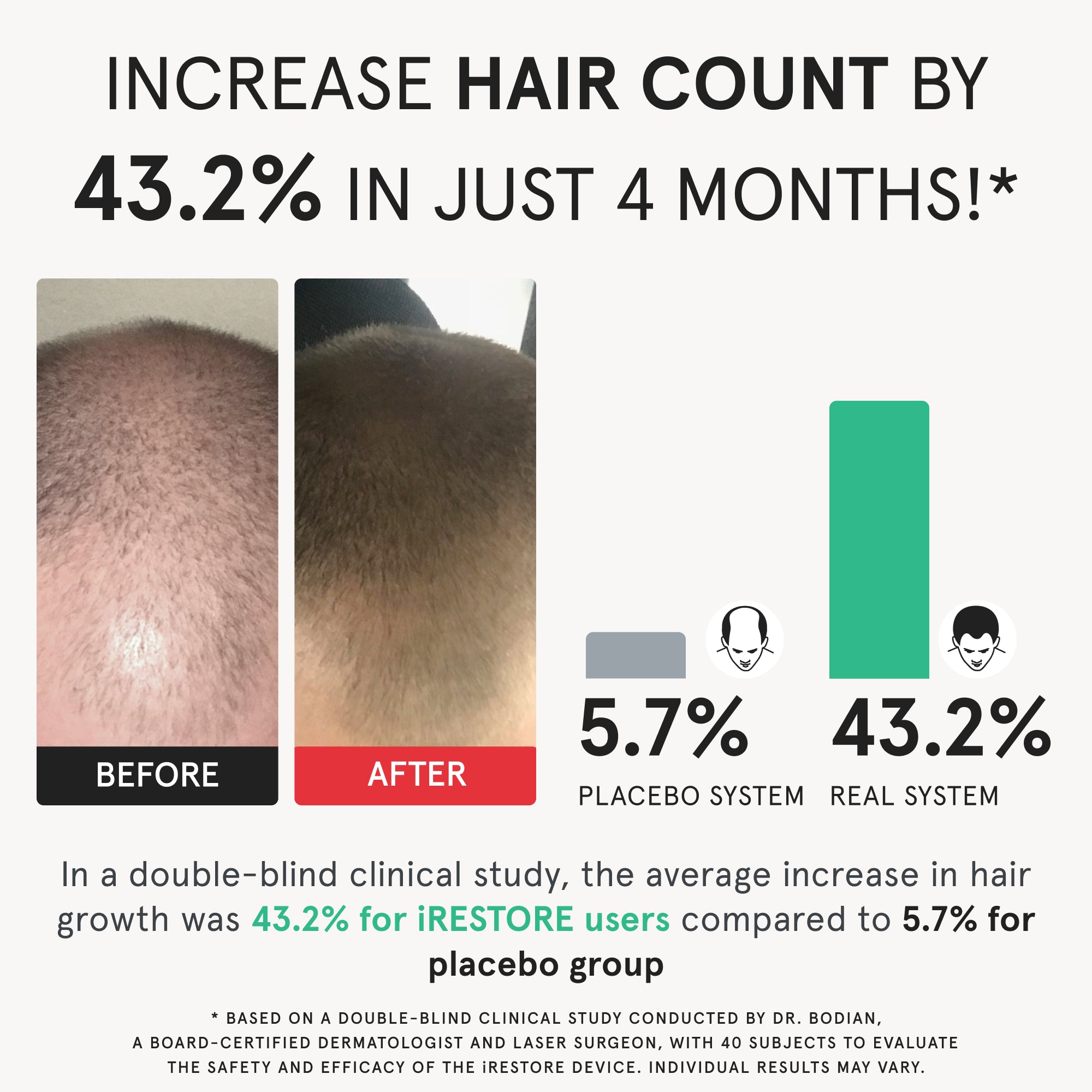 A diagram showing a before and after photo of a man and bar graph showing the clinical study result conducted to evaluate the safety and efficacy of the iRESTORE device. Increase hair count by 43.2% in just 4 months. In a double-clinical study, the average increase in hair growth was 43.2% for iRESTORE users compared to 5.7% for placebo group. 