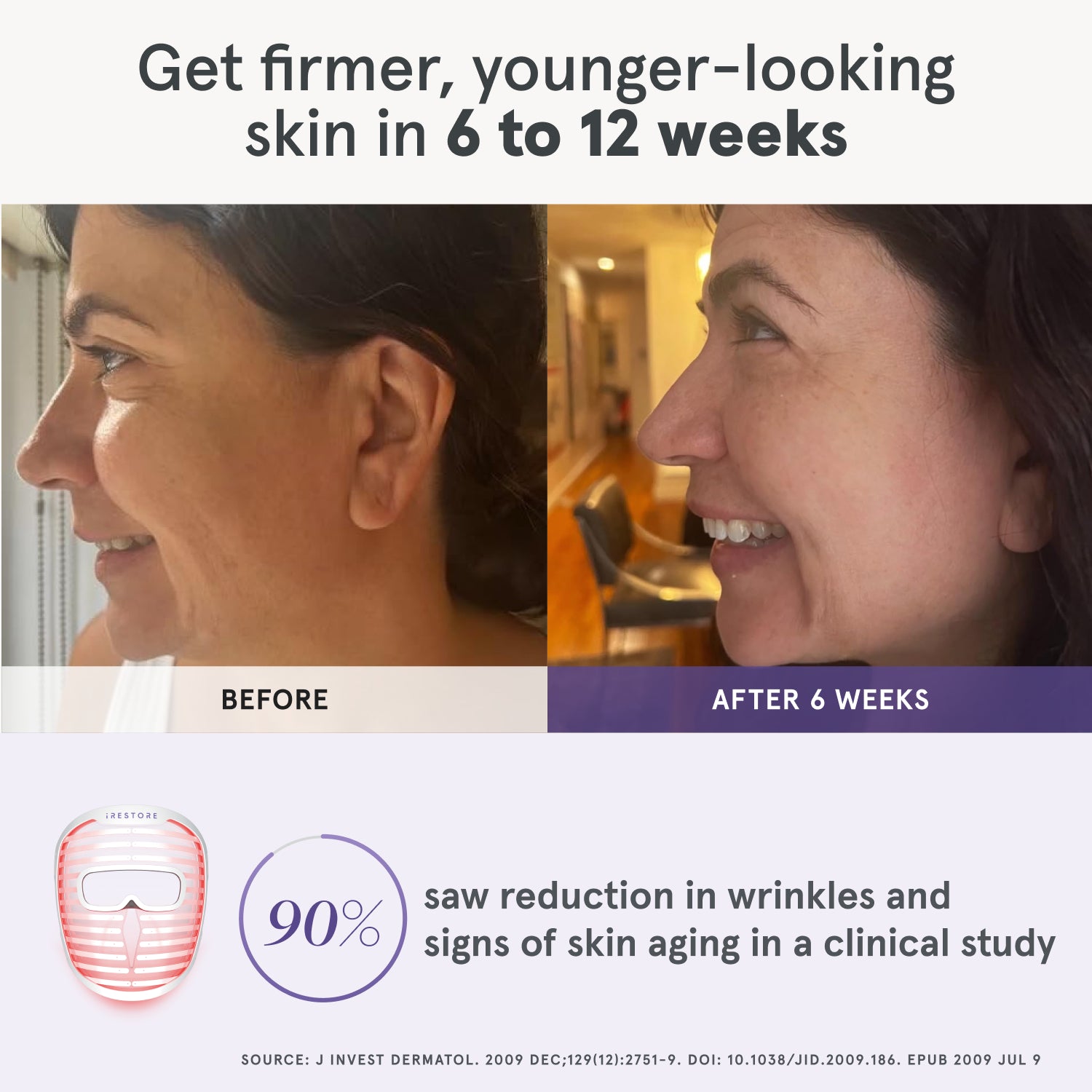 Side-by-side comparison of a woman’s profile showing visible improvements in skin firmness and reduced wrinkles after using the iRESTORE LED face mask for 6 weeks, with a clinical study statistic highlighting 90% of users experienced reduced signs of aging